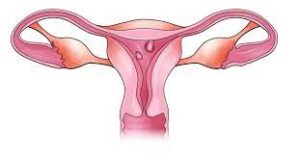 لحمية الرحم