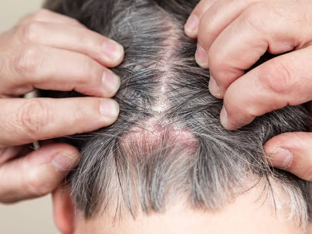 اضرار الخروع