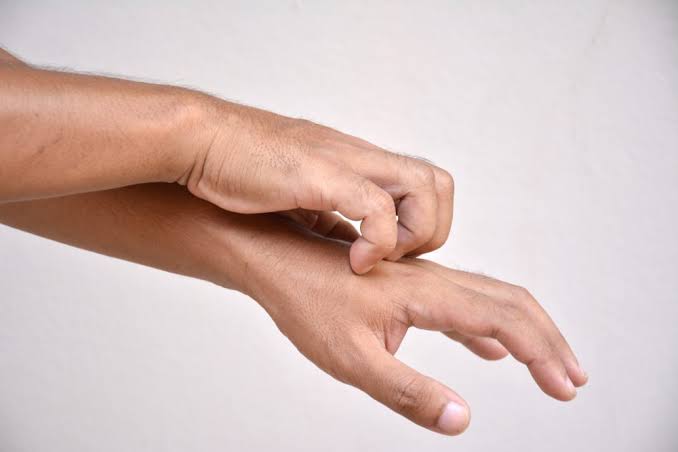 أعراض جلد الوزة