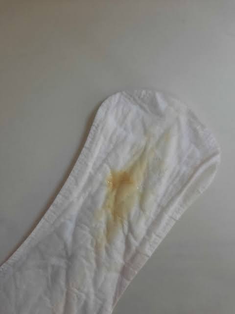 شكل إفرازات الحمل قبل الدورة بالصور