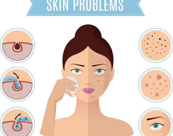 مشاكل البشرة