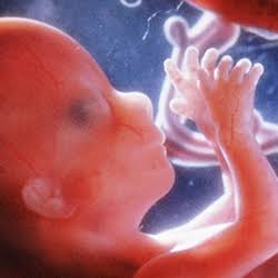 أضرار الصيام على الحامل