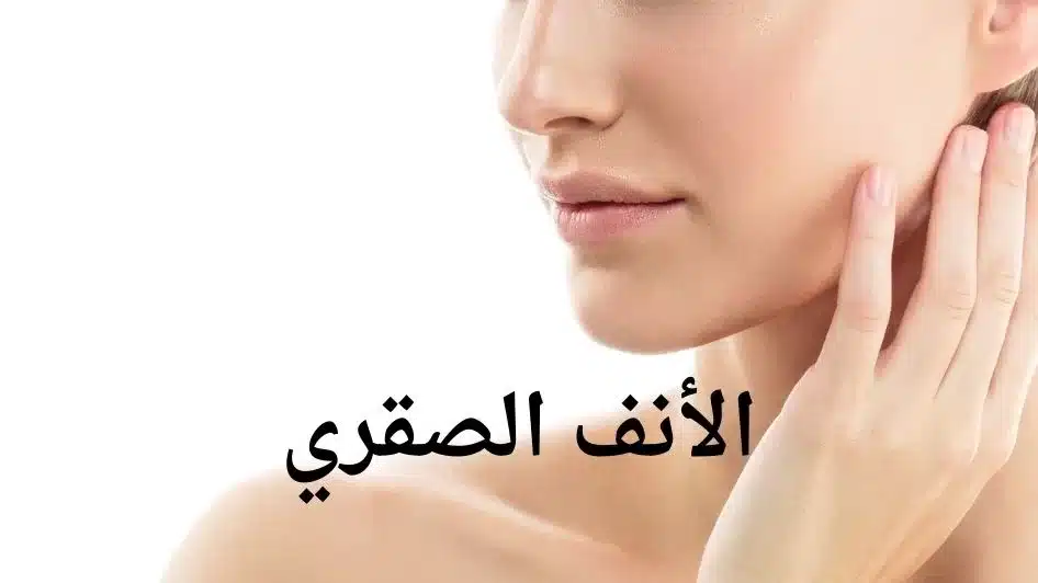 الأنف الصقري