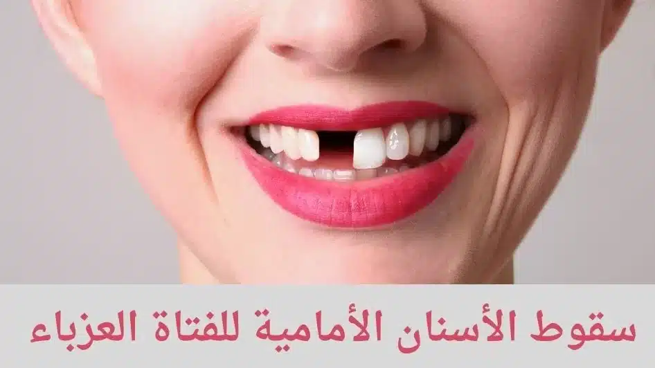 سقوط الأسنان الأمامية للفتاة العزباء