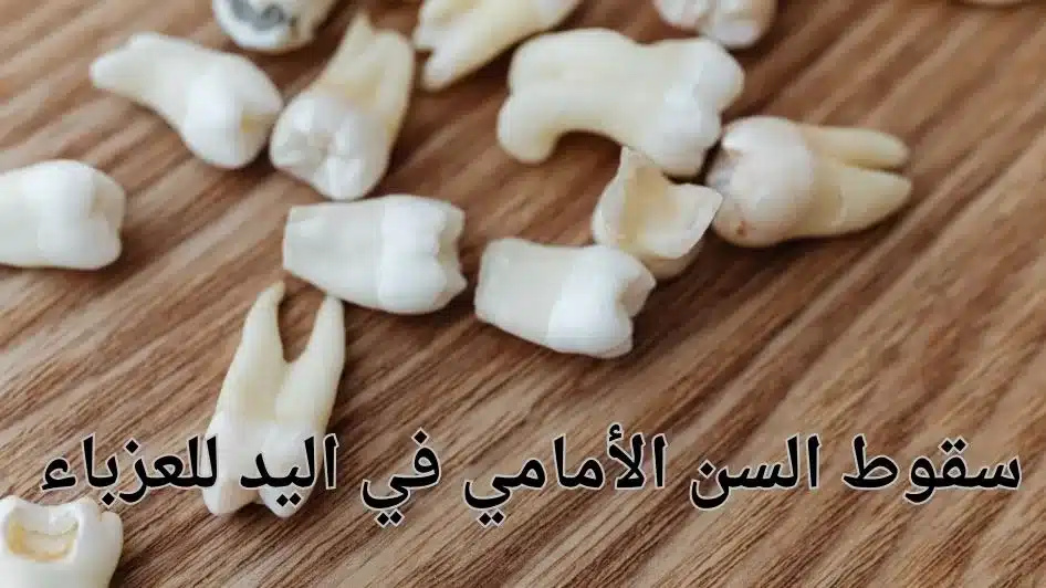 سقوط السن الأمامي في اليد للعزباء