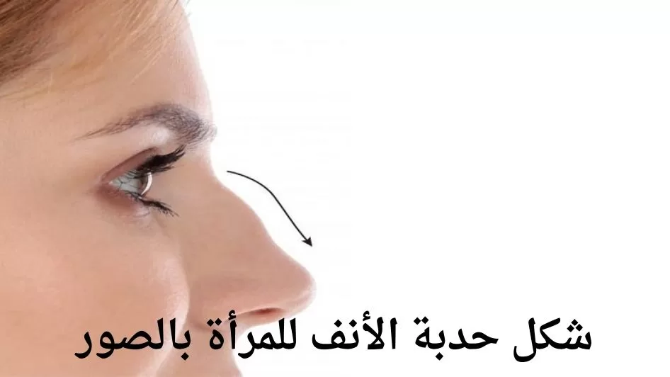 شكل حدبة الأنف للمرأة بالصور