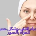 معني حدباء الانف وشكل حدبة الأنف للمرأة بالصور