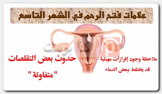 علامات فتح الرحم في الشهر التاسع فتح الرحم وتسريع الطلق