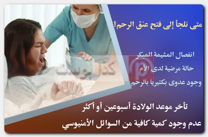 متى نلجأ إلى فتح عنق الرحم؟ فتح الرحم وتسريع الطلق